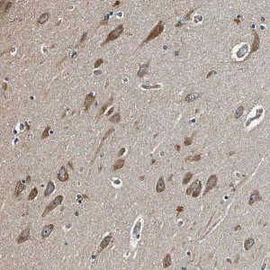 Anti-MIB1 antibody produced in rabbit 