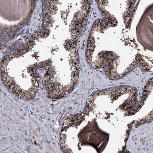 Anti-MICALCL antibody produced in rabbit 