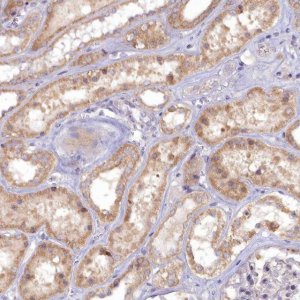 Anti-MICU2 antibody produced in rabbit 