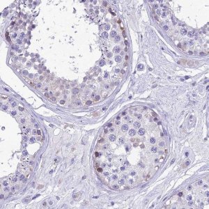 Anti-MIIP antibody produced in rabbit 