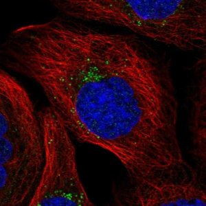 Anti-MITD1 antibody produced in rabbit 