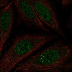 Anti-MKNK2 antibody produced in rabbit 