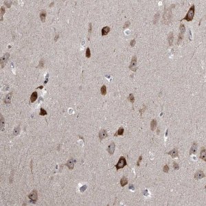 Anti-MLLT1 antibody produced in rabbit 