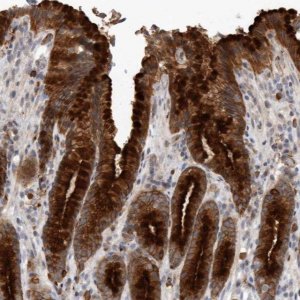 Anti-MLPH antibody produced in rabbit 