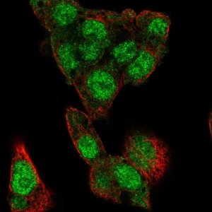 Anti-MLXIPL antibody produced in rabbit 