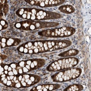 Anti-MMAA antibody produced in rabbit 