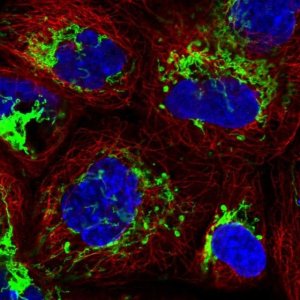Anti-MMAB antibody produced in rabbit 