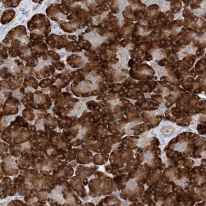 Anti-MMADHC antibody produced in rabbit 