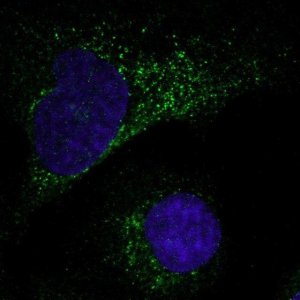 Anti-MMP1 antibody produced in rabbit 