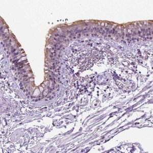 Anti-MMP27 antibody produced in rabbit 