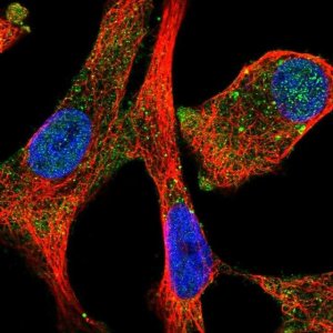 Anti-MMP7 antibody produced in rabbit 