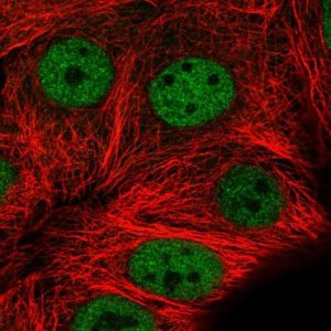 Anti-MMS19 antibody produced in rabbit 