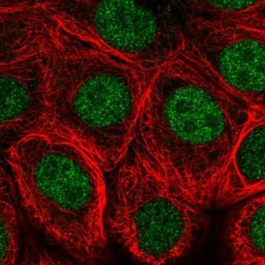 Anti-MNX1 antibody produced in rabbit 