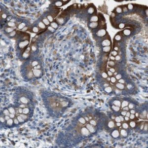 Anti-MOGAT3 antibody produced in rabbit 