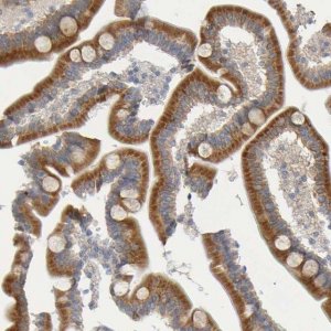 Anti-MOGS antibody produced in rabbit HPA011969-100UL
