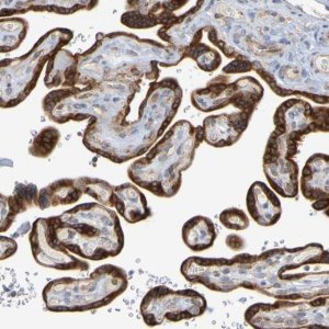 Anti-MOGS antibody produced in rabbit HPA011969-100UL