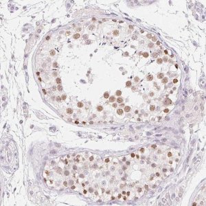 Anti-MORC1 antibody produced in rabbit 
