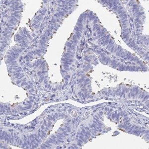 Anti-MORN2 antibody produced in rabbit 