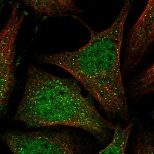 Anti-MOSPD1 antibody produced in rabbit 