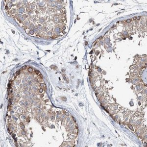 Anti-MPHOSPH9 antibody produced in rabbit 