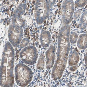 Anti-MPI antibody produced in rabbit 