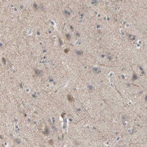 Anti-MPI antibody produced in rabbit 