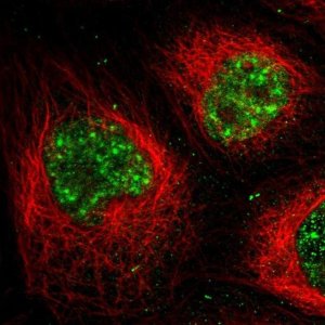 Anti-MPP1 antibody produced in rabbit 