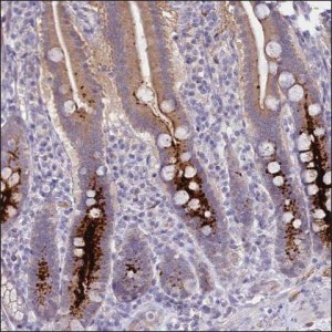 Anti-MPPED2 antibody produced in rabbit HPA039265-100UL