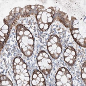 Anti-MRAP antibody produced in rabbit 