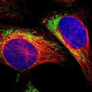 Anti-MRM1 antibody produced in rabbit 