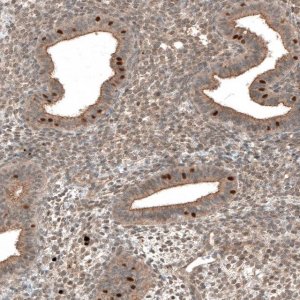 Anti-MRNIP antibody produced in rabbit 