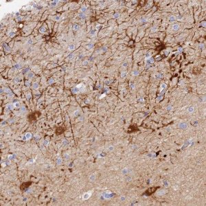 Anti-MROH1 antibody produced in rabbit 
