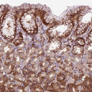 Anti-MROH2A antibody produced in rabbit 
