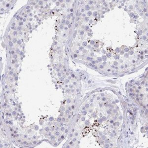 Anti-MROH2B antibody produced in rabbit 
