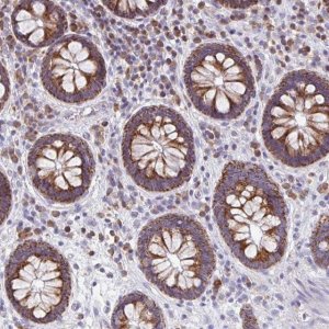 Anti-MRPL11 antibody produced in rabbit 