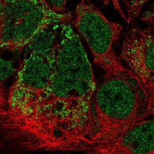 Anti-MRPL2 antibody produced in rabbit 