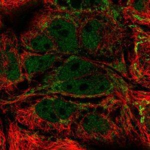 Anti-MRPL21 antibody produced in rabbit 
