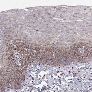 Anti-MRPL3 antibody produced in rabbit 