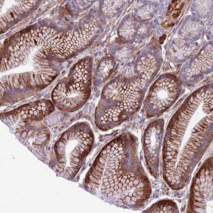 Anti-MRPL32 antibody produced in rabbit 