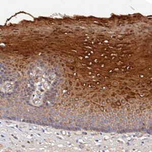 Anti-MRPL35 antibody produced in rabbit 