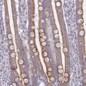 Anti-MRPS2 antibody produced in rabbit HPA057261-100UL
