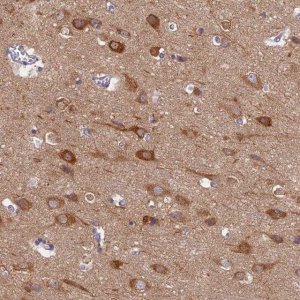Anti-MRPS25 antibody produced in rabbit HPA043490-100UL