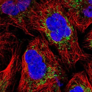 Anti-MRPS25 antibody produced in rabbit HPA043490-100UL