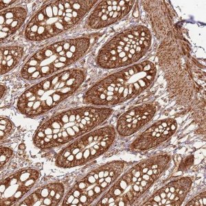 Anti-MRPS6 antibody produced in rabbit 