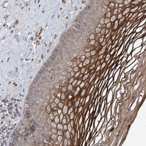 Anti-MSANTD2 antibody produced in rabbit 
