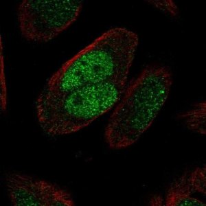 Anti-MSH2 antibody produced in rabbit 