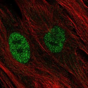 Anti-MT1E antibody produced in rabbit 