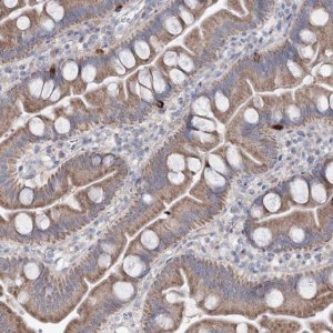 Anti-MTCH2 antibody produced in rabbit 