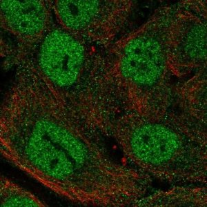 Anti-MTCP1 antibody produced in rabbit 