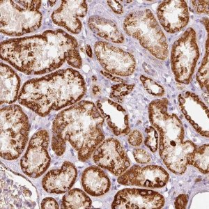 Anti-MTHFD2 antibody produced in rabbit 